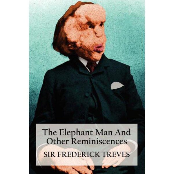 Elephant Man